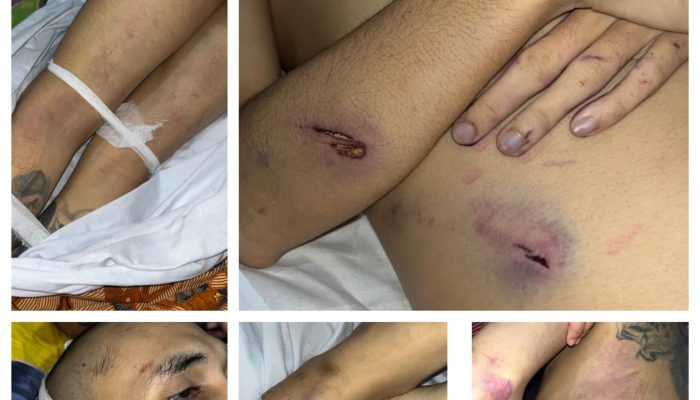 RAJS (26) korban tewas di Rutan Kelas I Depok oleh sesama tahanan. (dok. Harianesia.com)