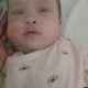 Bayi 10 Bulan Asal Cikupa Terkendala Denda BPJS Rp400 Ribu, Operasi Mata di RSCM Tertunda