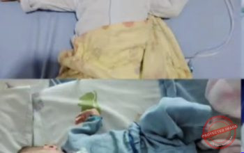 Butuh Rp90 Juta untuk Operasi Jantung, Bayi 10 Bulan di Kelapa Dua Tangerang Berjuang Melawan PJB