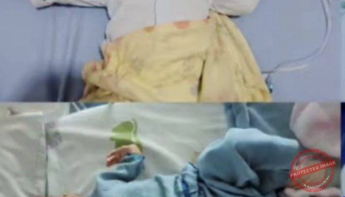 Butuh Rp90 Juta untuk Operasi Jantung, Bayi 10 Bulan di Kelapa Dua Tangerang Berjuang Melawan PJB