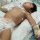 Balita Pejuang Trakeostomi di Bojong Gede Butuh Uluran Tangan, Kanul Merek Shiley PO Singapura dan Susu Khusus Tak Tercover